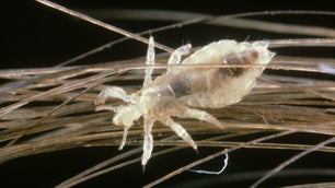 What head lice can tell us about human migration